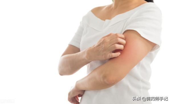 皂角刺善於祛風,用於面板起“小疙瘩”還瘙癢,以及風疹、蕁麻疹 皂角刺善於祛風,用於面板起“小疙瘩”還瘙癢,以及風疹、蕁麻疹