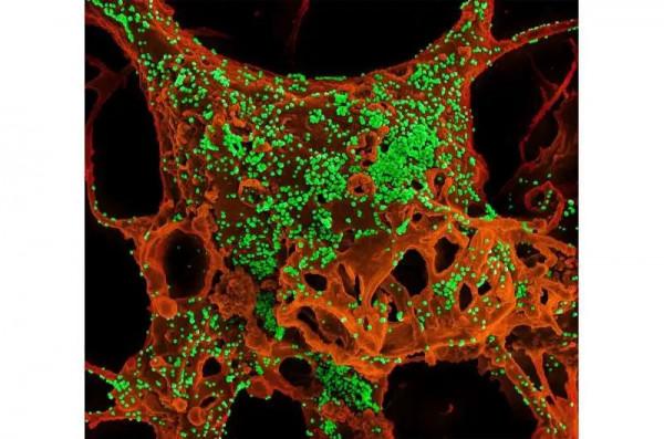 「mBio」冠狀病毒感染的罪魁禍首竟是細胞的“質量控制系統” 「mBio」冠狀病毒感染的罪魁禍首竟是細胞的“質量控制系統”