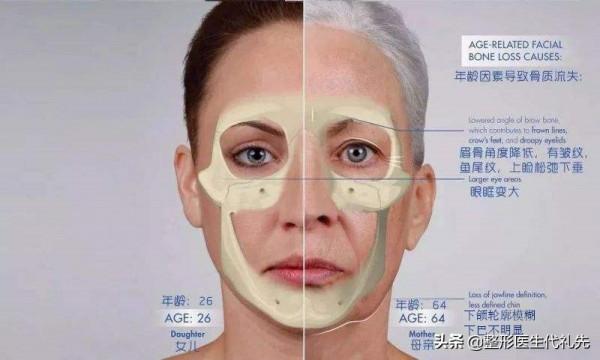 面部開始鬆弛下垂衰老的三大訊號，一定要開始注意了