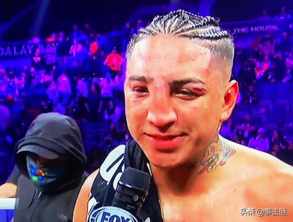 全場被擊中181拳，巴里奧斯確認鼻樑斷裂，拳迷調侃像阿凡達