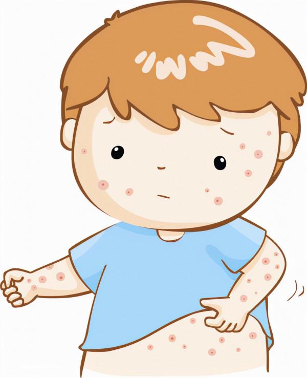 常見的面部面板病的種類及症狀有哪些 常見的面部面板病的種類及症狀有哪些