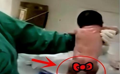 暴躁新生兒”走紅，臍帶沒剪就要跑，護士哭笑不得：差點就沒抓住