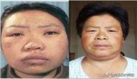 臨床基本功:一眼診病 臨床基本功:一眼診病