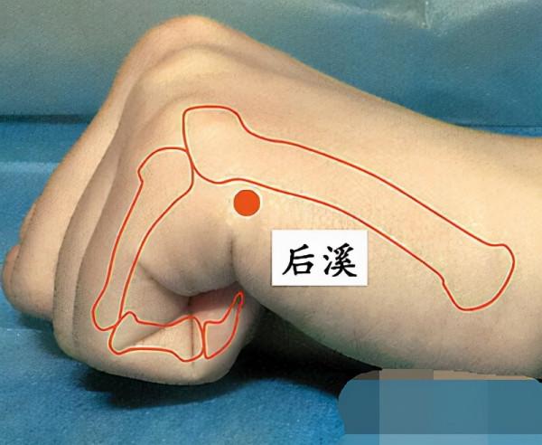 中醫針灸頸部疾病處方1