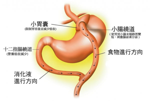 故事:韓國25歲小哥天生有兩個胃,一頓吃100個肉夾饃,他真吃不飽?