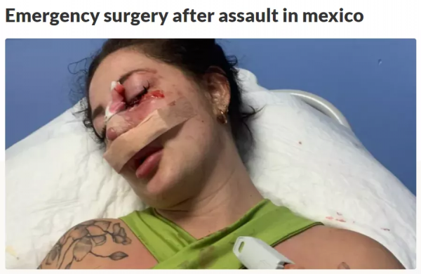 溫哥華美女旅遊勝地遭人痛毆毀容 險些癱瘓 施暴者竟是加拿大老鄉 溫哥華美女旅遊勝地遭人痛毆毀容 險些癱瘓 施暴者竟是加拿大老鄉