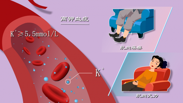 胳膊腿為啥沒力?躺著不動也心亂跳?動漫揭秘高鉀血癥致死全過程 胳膊腿為啥沒力?躺著不動也心亂跳?動漫揭秘高鉀血癥致死全過程