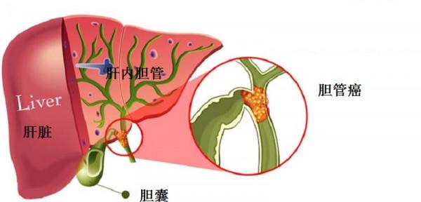 女子月經不調就醫38天后死亡，死亡原因到底是什麼？