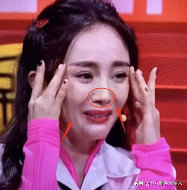 那些亂整鼻子的女明星還好嗎？後遺症一大堆，楊冪金晨都開始崩了