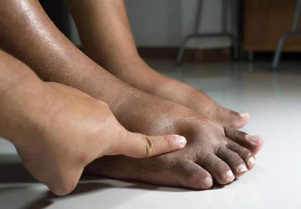 糖尿病患者，除了注意控制血糖外，這3個現象，也不能大意