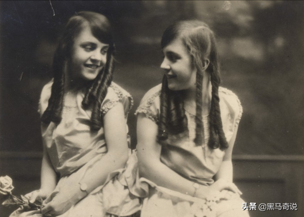 連體人的感官相通嗎，他們共用一個身體，一個死亡另一個會怎樣？