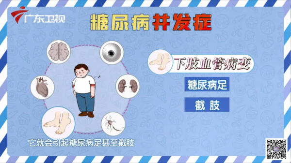 每一個想要管好血糖的人，請收藏好這份控糖妙方