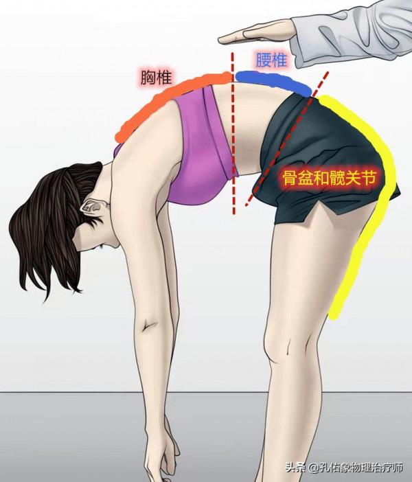 腰腿疼，竟是骨盆惹的禍！還在整天拿著腰椎看嗎？一文告訴您