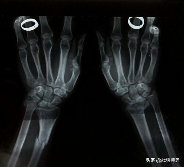 “爸爸休息會兒，我守檔口”他停下顫抖雙手抱著患病兒子眼眶溼了