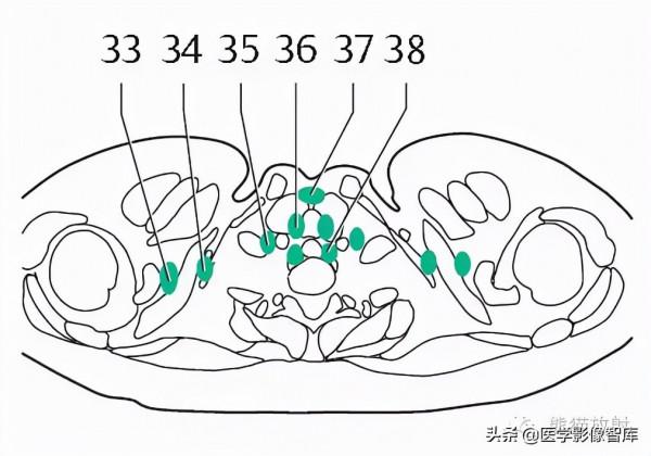 CT斷層解剖圖譜最全總結「推薦收藏」 CT斷層解剖圖譜最全總結「推薦收藏」