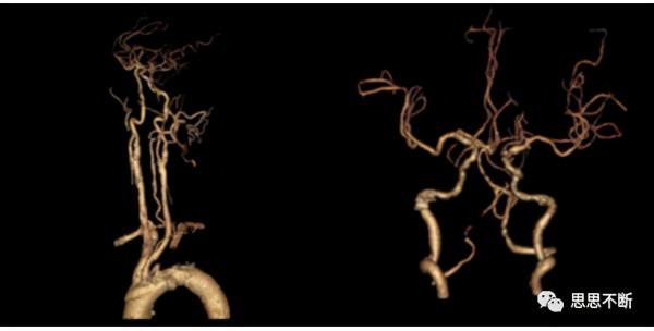 資訊科技如何幫助解決醫療兩大難題？