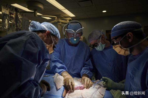 美研究團隊將豬腎移植人體，成功運作無排斥反應