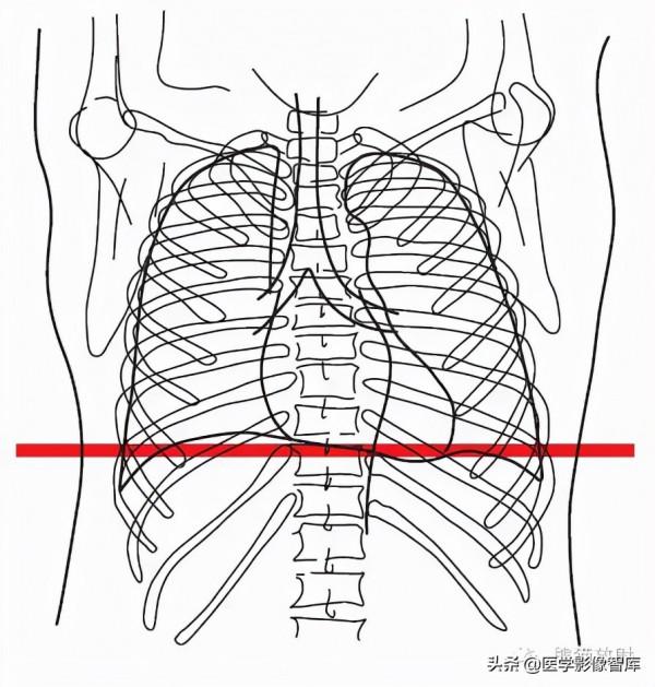 CT斷層解剖圖譜最全總結「推薦收藏」 CT斷層解剖圖譜最全總結「推薦收藏」
