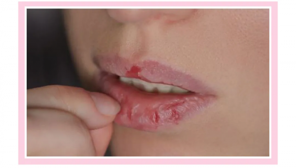 15款秋冬“續命”潤唇膏!get水潤嘟嘟唇 15款秋冬“續命”潤唇膏!get水潤嘟嘟唇