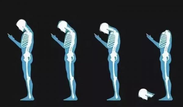 讓手機摧殘頸椎的年輕人，別讓“頸椎病”拖垮你，快來看這裡