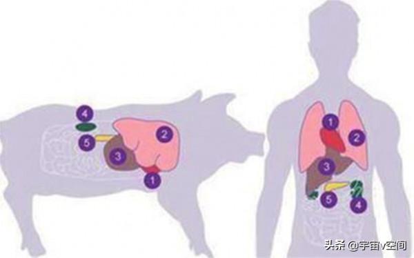 豬腎人用?美國成功地將豬腎移植到病人身上,併產生了人尿 豬腎人用?美國成功地將豬腎移植到病人身上,併產生了人尿