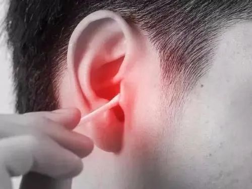耳朵癢卻又掏不出東西?可能在暗示你這5個問題,別忽視了 耳朵癢卻又掏不出東西?可能在暗示你這5個問題,別忽視了