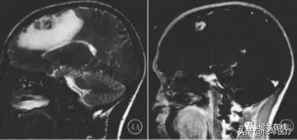 這種吃螃蟹吃出的怪病,影像醫生都是怎麼診斷的?|倫琴醫療 這種吃螃蟹吃出的怪病,影像醫生都是怎麼診斷的?|倫琴醫療
