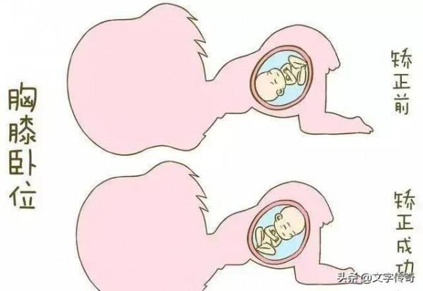 001 實習醫生初入婦產科