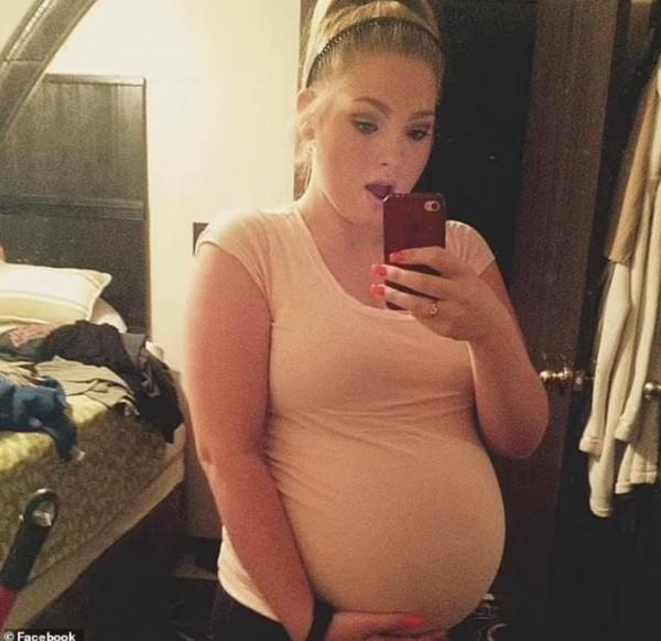 美國罕見雙子宮媽媽，一邊各懷一個娃，22周半早產只存活一個