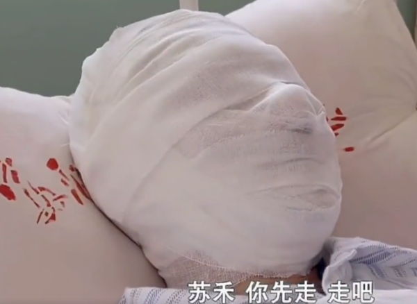 有人熱油澆臉不起泡，有人臉被燙熟創醫療奇蹟，國產劇毀容太離譜