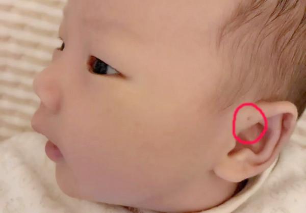 耳朵上有“聰明孔”的人更聰明，這種說法是真的嗎？螞蟻莊園答案