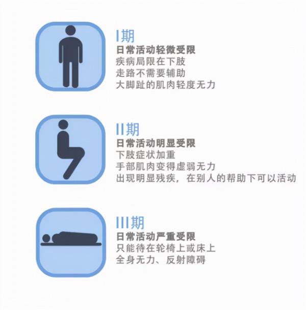 70歲大媽被診斷為“澱粉人”，家族中數人罹患，全球患者不超過5萬例