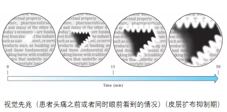 【醫聊】有一種痛叫偏頭痛,囂張得來無影去無蹤 【醫聊】有一種痛叫偏頭痛,囂張得來無影去無蹤