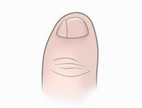 那些小腳趾指甲分成兩瓣的人,到底是什麼來歷?你的指甲是這樣嗎 那些小腳趾指甲分成兩瓣的人,到底是什麼來歷?你的指甲是這樣嗎