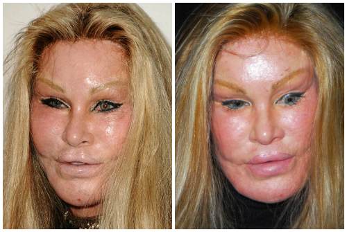 整容富婆“貓女”：離婚獲得25億美元，如今僅靠900美元維持生活