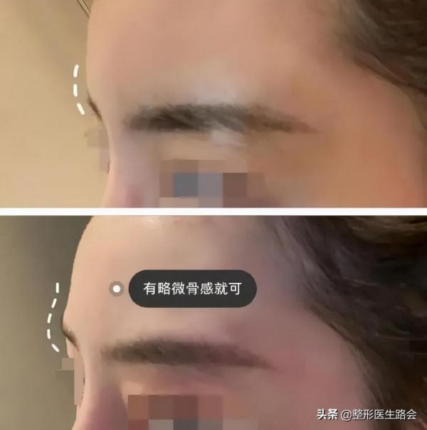 眉弓——讓你變“混血”的點睛之筆? 眉弓——讓你變“混血”的點睛之筆?