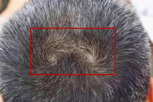 “雙頂男孩找不到，雙頂女孩沒人要”，雙頂指啥？有道理嗎？