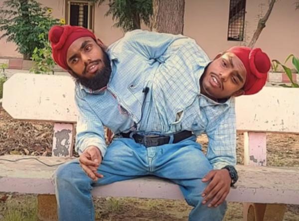 印度連體雙胞胎剛出生就被遺棄，如今一起找到工作，拿雙份工資