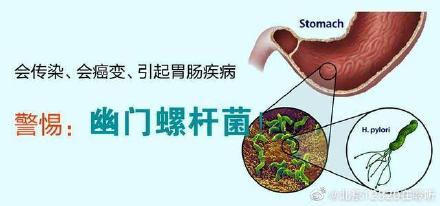 感染幽門螺旋桿菌後有什麼臨床症狀 如何預防