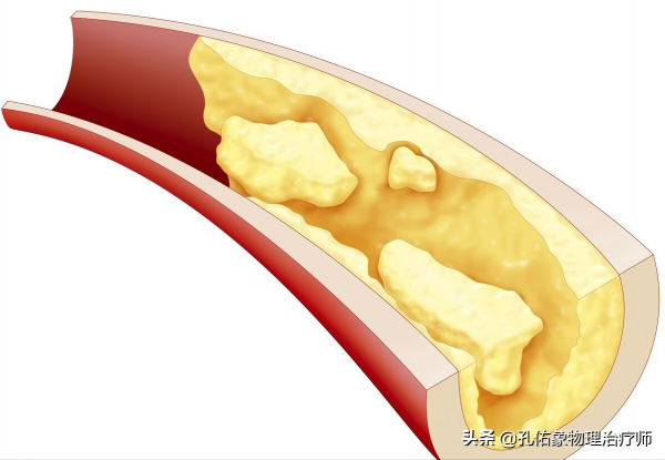 老年人如何對抗衰老，更健康的活著？這幾點建議，給您詳細分享