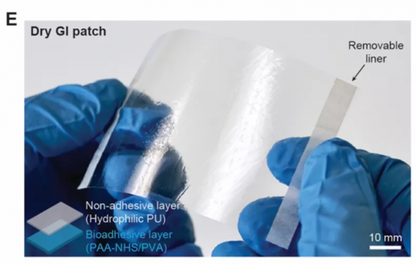 華科校友研發可降解&OpenCurlyDoubleQuote;腸道創可貼&rdquo;，能用於胃腸道缺損無縫修復