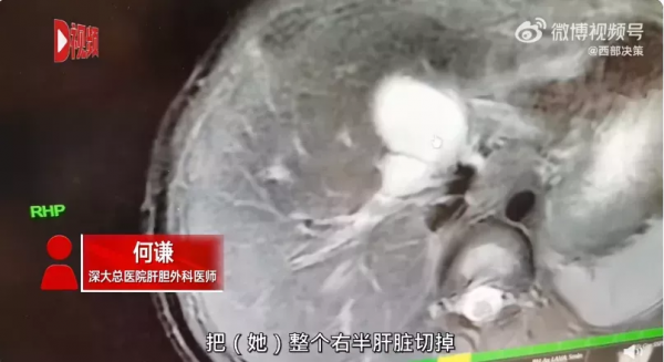 “新年第二天，我躺進了醫院ICU”：這3件事，成了我們一生最難的自律