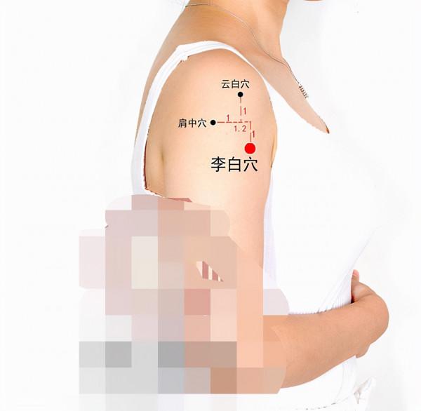 中醫針灸肩部疾病處方1 中醫針灸肩部疾病處方1