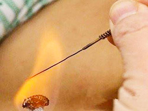 正月裡不能剃頭，是和我們的健康有關係