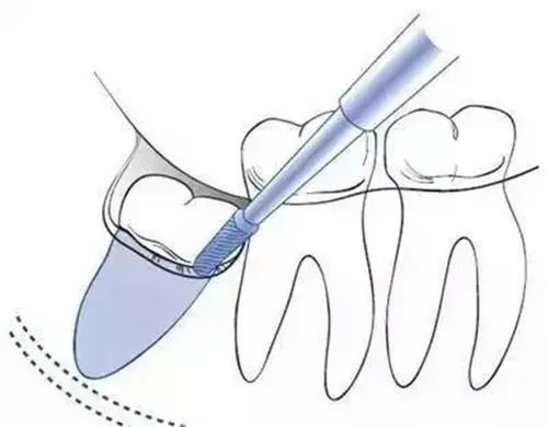 人類正在加速進化的三大證據