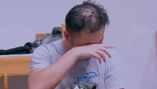 發腮禿頭、酒糟鼻、大肚腩，還有塑膠僵臉，中年男星的辣眼震撼