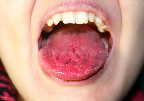 失眠是不是一直困擾著你？別急，今天和老師給大家聊聊失眠