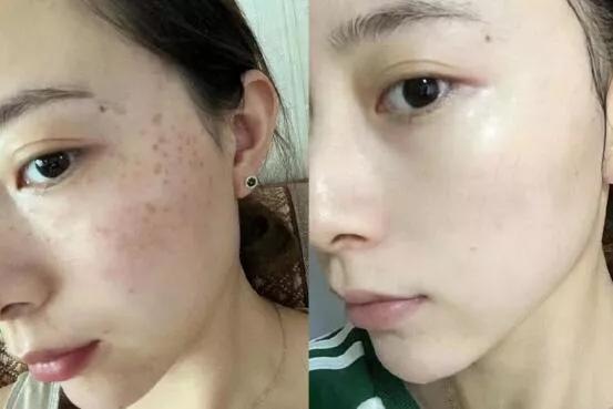 4種“買得起”的護膚品，別嫌棄是小眾品牌，效果一點不輸大牌