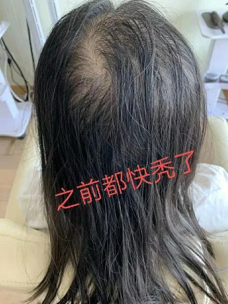 多吃水果黑米粥,居然真的長頭髮了‼️‼️ 多吃水果黑米粥,居然真的長頭髮了‼️‼️