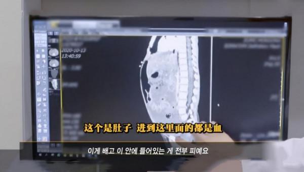 2020年,韓國女童被領養271天后被養父母虐殺,屍檢結果不忍細看 2020年,韓國女童被領養271天后被養父母虐殺,屍檢結果不忍細看